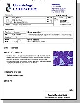 Dermatopathology Report Example